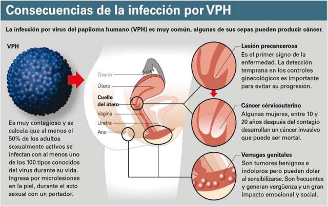 hpv1